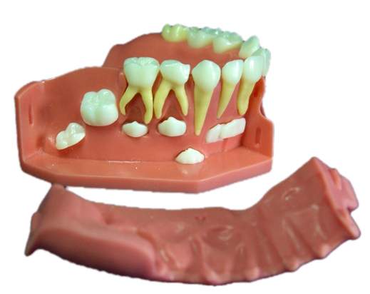 <b>牙列发育模型B</b>